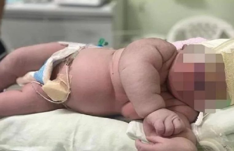 Bayi lelaki 7kg dilahirkan di Chile