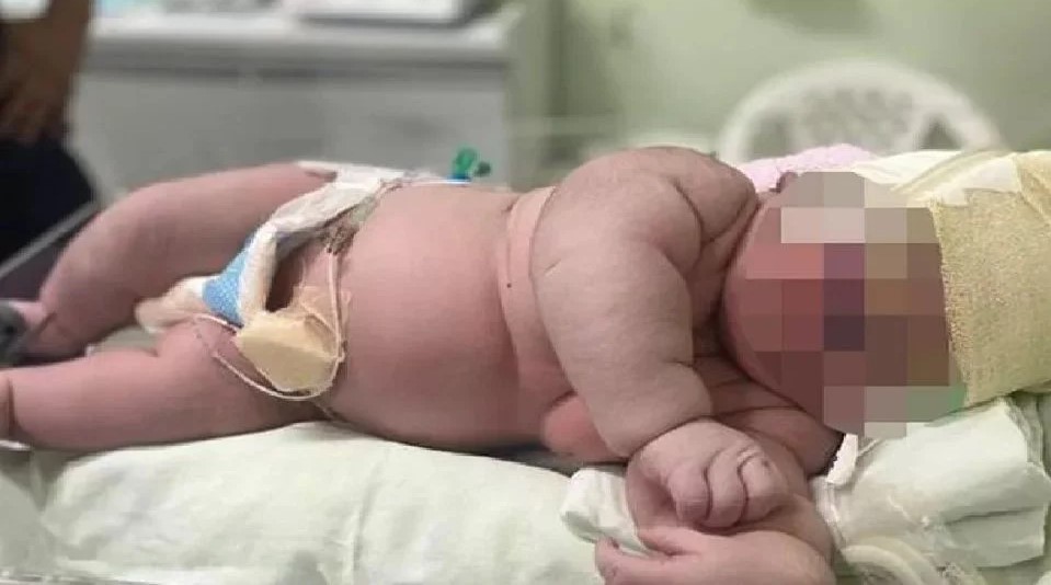 Bayi lelaki 7kg dilahirkan di Chile